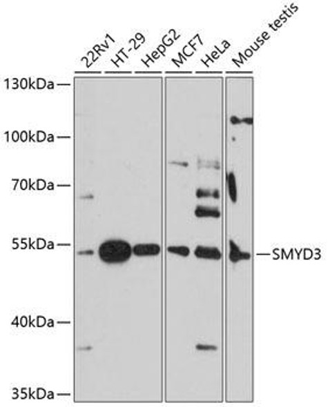 Cell Biology Antibodies 5 Anti-SMYD3 Antibody CAB14516