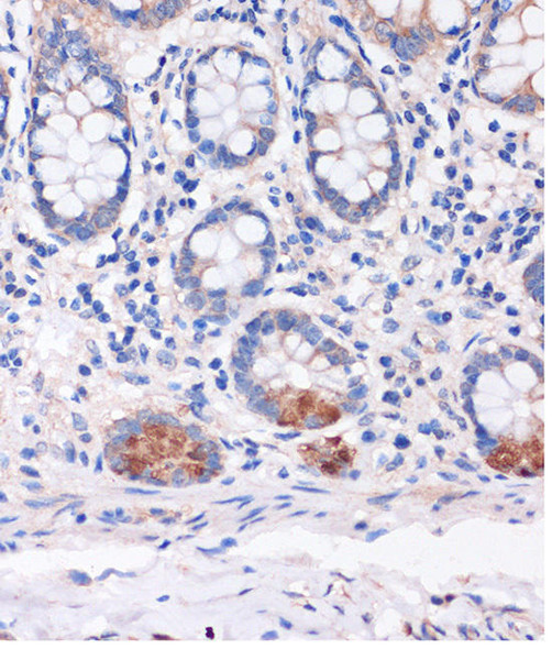 Cell Biology Antibodies 5 Anti-SMYD3 Antibody CAB14516