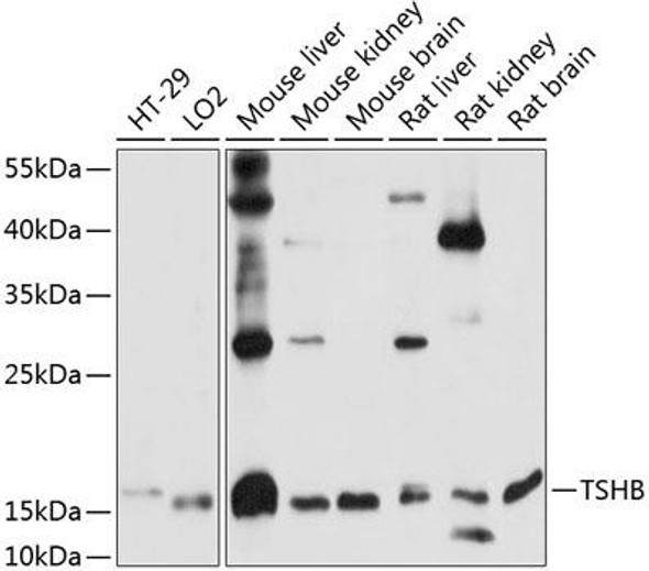 Cell Biology Antibodies 5 Anti-TSHB Antibody CAB14523