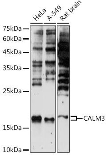 Cell Biology Antibodies 5 Anti-CALM3 Antibody CAB14526