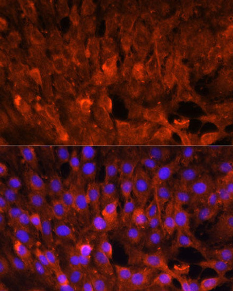 Developmental Biology Anti-CISH Antibody CAB14527