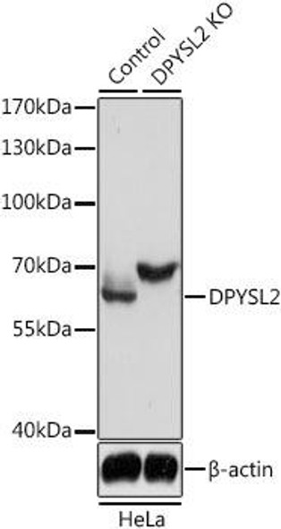 KO Validated Antibodies 1 Anti-DPYSL2 Antibody CAB14570KO Validated