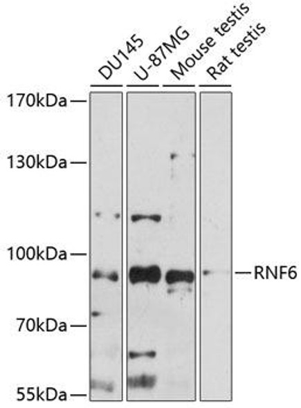 Signal Transduction Antibodies 1 Anti-RNF6 Antibody CAB14572