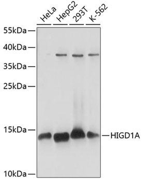 Cell Biology Antibodies 5 Anti-HIGD1A Antibody CAB14582