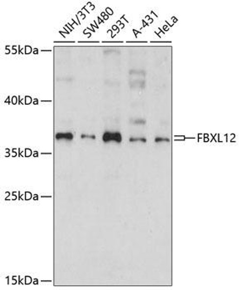 Signal Transduction Antibodies 1 Anti-FBXL12 Antibody CAB14589