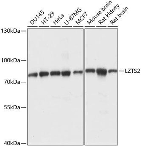 Cell Cycle Antibodies 1 Anti-LZTS2 Antibody CAB14598