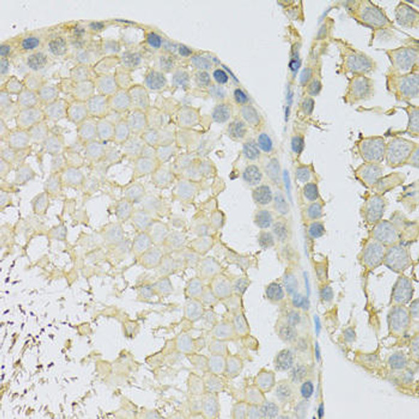 Signal Transduction Antibodies 1 Anti-SLC2A9 Antibody CAB14606