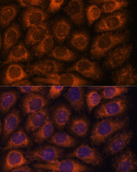 Signal Transduction Antibodies 1 Anti-CCT6B Antibody CAB14615