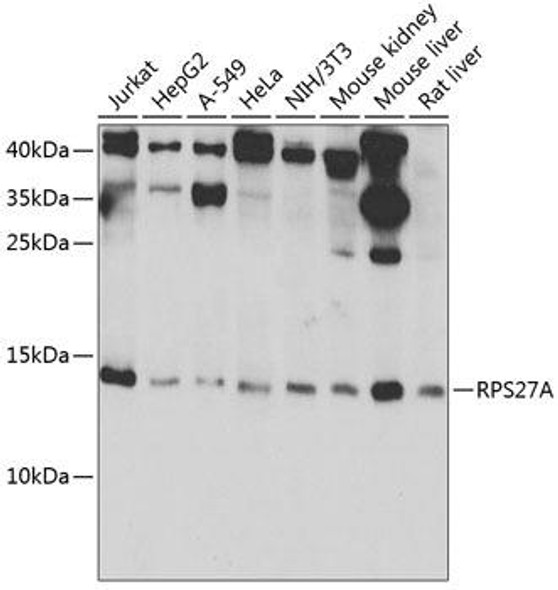 Cell Biology Antibodies 5 Anti-RPS27A Antibody CAB14618