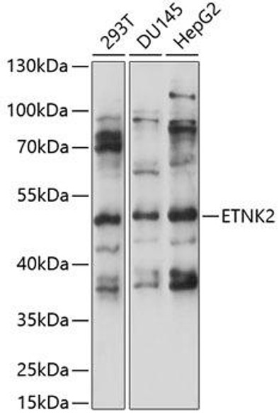 Metabolism Antibodies 1 Anti-ETNK2 Antibody CAB14628