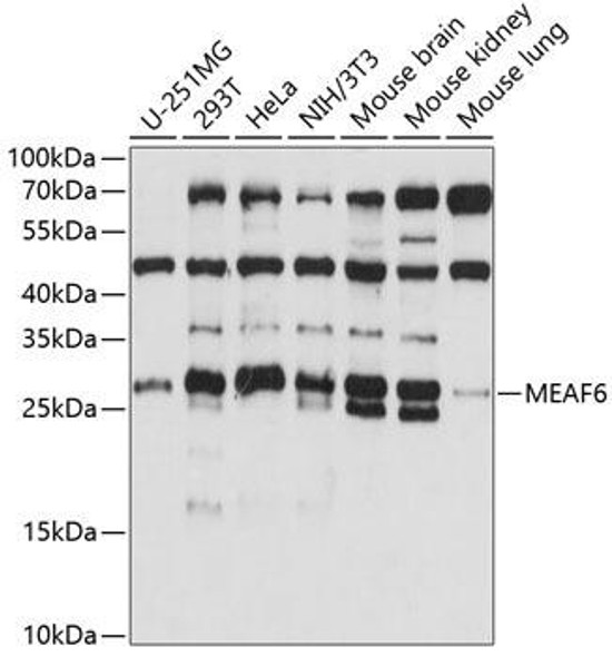 Epigenetics and Nuclear Signaling Antibodies 3 Anti-MEAF6 Antibody CAB14629