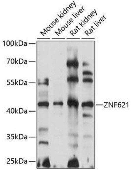 Epigenetics and Nuclear Signaling Antibodies 3 Anti-ZNF621 Antibody CAB14634