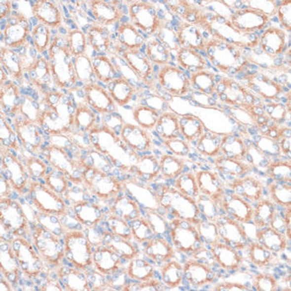 Cell Biology Antibodies 5 Anti-PDGFD Antibody CAB14653