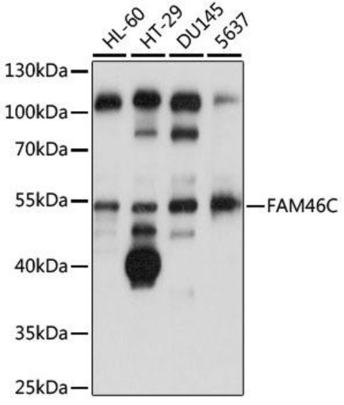 Immunology Antibodies 1 Anti-FAM46C Antibody CAB14661