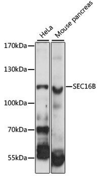 Cell Biology Antibodies 5 Anti-SEC16B Antibody CAB14678