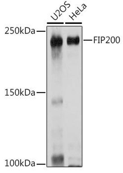Autophagy Antibodies Anti-FIP200 Antibody CAB14685