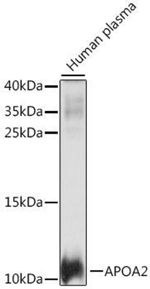 Immunology Antibodies 1 Anti-APOA2 Antibody CAB14690