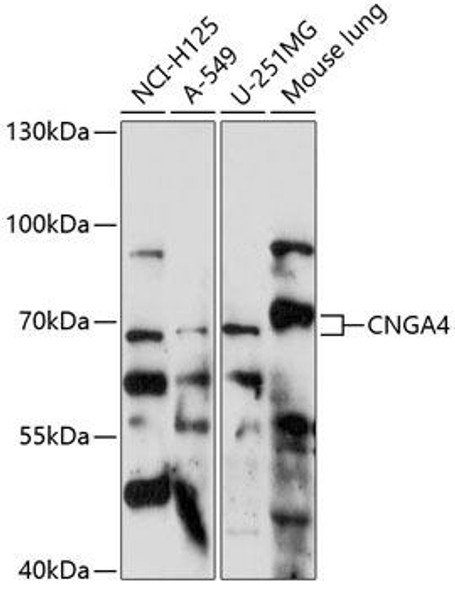 Signal Transduction Antibodies 1 Anti-CNGA4 Antibody CAB14719