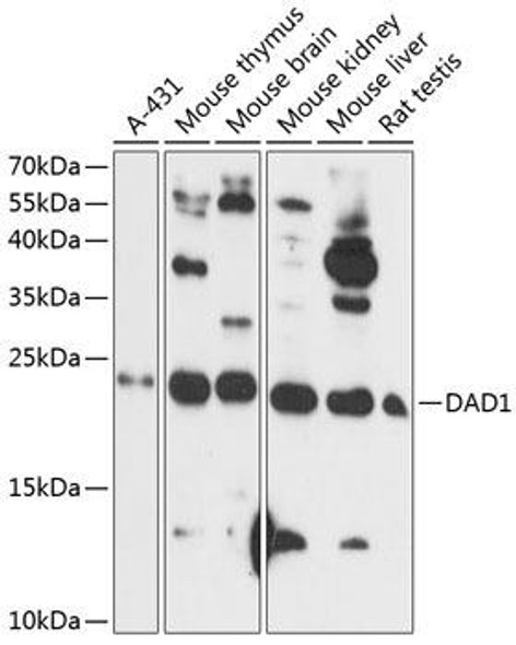 Cell Death Antibodies 1 Anti-DAD1 Antibody CAB14723