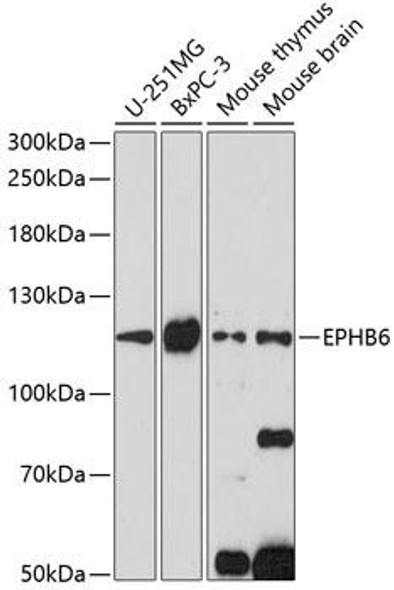 Neuroscience Anti-EPHB6 Antibody CAB14728