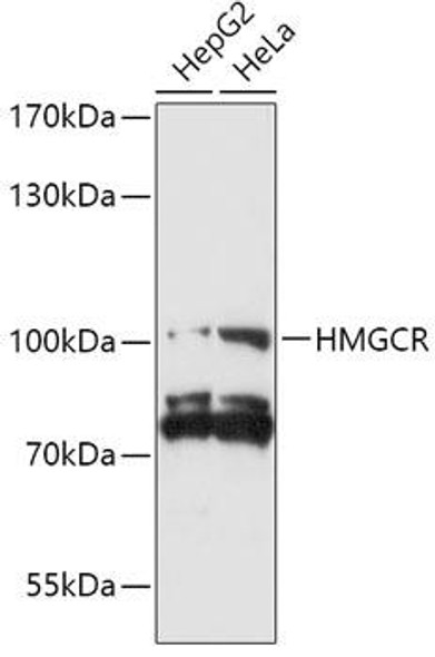 KO Validated Antibodies 1 Anti-HMGCR Antibody CAB14741KO Validated