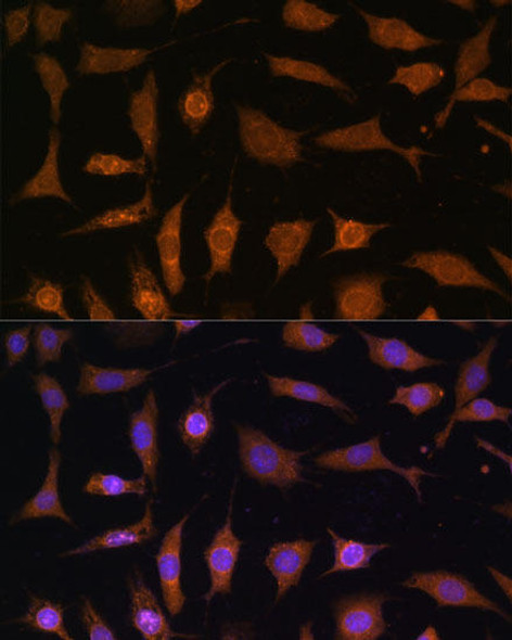 Signal Transduction Antibodies 1 Anti-PDE6D Antibody CAB14762