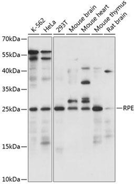 Metabolism Antibodies 1 Anti-RPE Antibody CAB14778