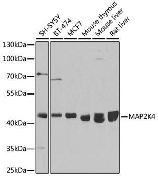 KO Validated Antibodies 1 Anti-MAP2K4 Antibody CAB14781KO Validated
