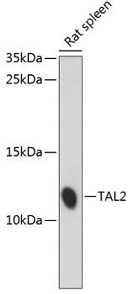 Epigenetics and Nuclear Signaling Antibodies 2 Anti-TAL2 Antibody CAB14788