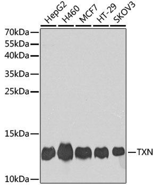 Cell Biology Antibodies 5 Anti-TXN Antibody CAB14793