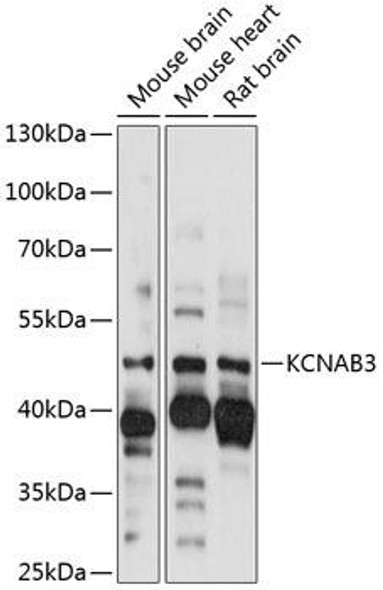 Signal Transduction Antibodies 1 Anti-KCNAB3 Antibody CAB14822