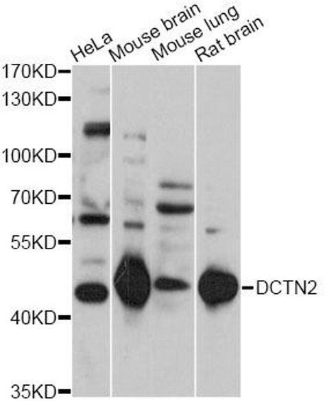 Cell Biology Antibodies 5 Anti-DCTN2 Antibody CAB14841