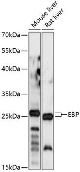 Metabolism Antibodies 1 Anti-EBP Antibody CAB14845
