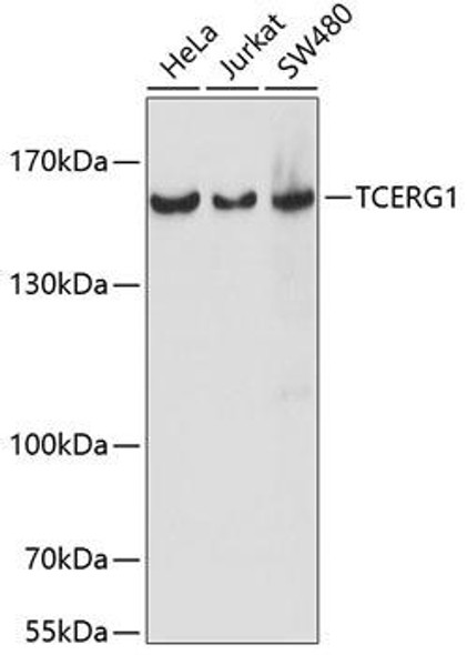 Epigenetics and Nuclear Signaling Antibodies 2 Anti-TCERG1 Antibody CAB14850