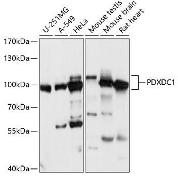 Cell Biology Antibodies 5 Anti-PDXDC1 Antibody CAB14856