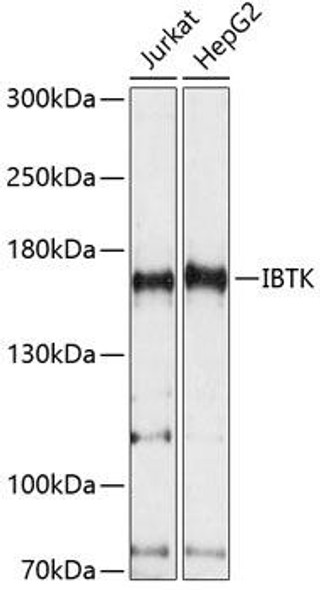 Cell Biology Antibodies 5 Anti-IBTK Antibody CAB14866