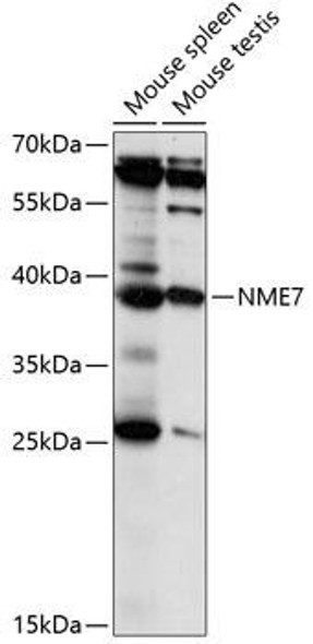 Metabolism Antibodies 1 Anti-NME7 Antibody CAB14882