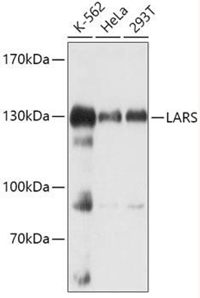 Metabolism Antibodies 1 Anti-LARS Antibody CAB14890