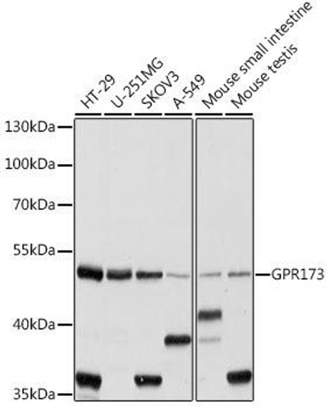 Signal Transduction Antibodies 2 Anti-GPR173 Antibody CAB14897