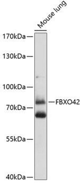 Signal Transduction Antibodies 2 Anti-FBXO42 Antibody CAB14898