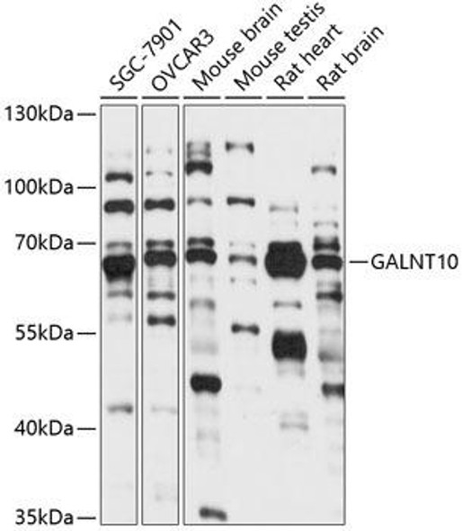 Cell Biology Antibodies 5 Anti-GALNT10 Antibody CAB14909