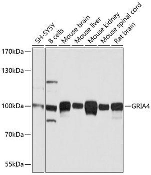 Signal Transduction Antibodies 2 Anti-GRIA4 Antibody CAB1492