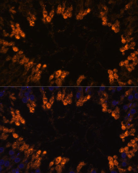 Cell Biology Antibodies 5 Anti-OXCT2 Antibody CAB14920