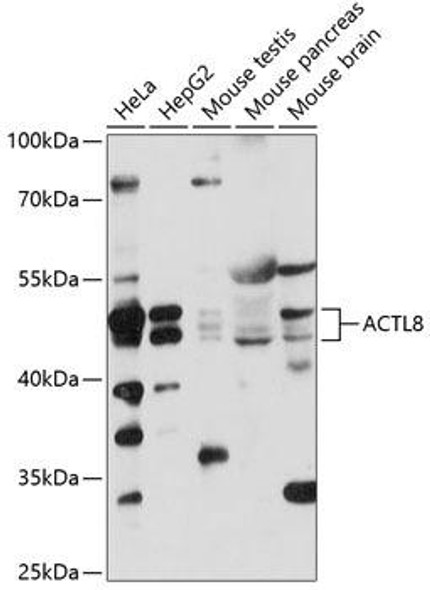 Signal Transduction Antibodies 2 Anti-ACTL8 Antibody CAB14937
