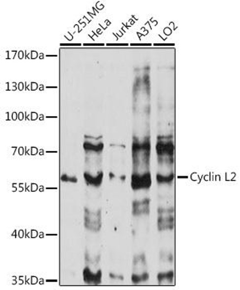 Epigenetics and Nuclear Signaling Antibodies 2 Anti-Cyclin L2 Antibody CAB14938