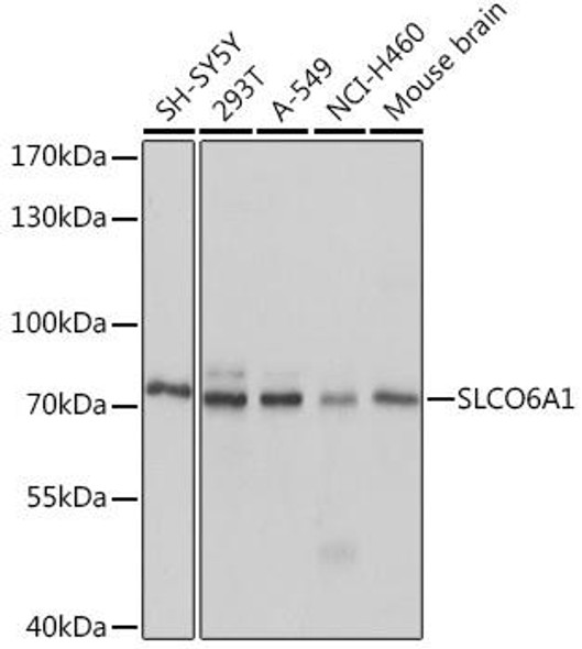 Signal Transduction Antibodies 2 Anti-SLCO6A1 Antibody CAB14963