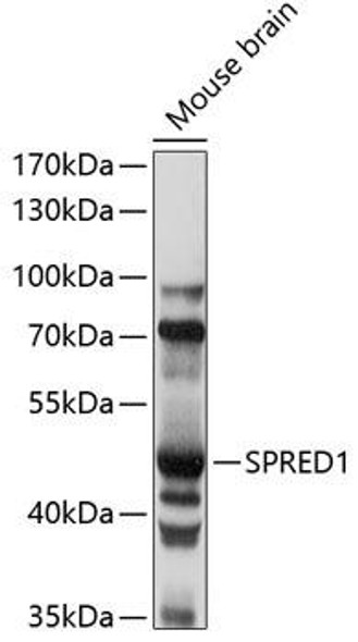 Signal Transduction Antibodies 2 Anti-SPRED1 Antibody CAB14970