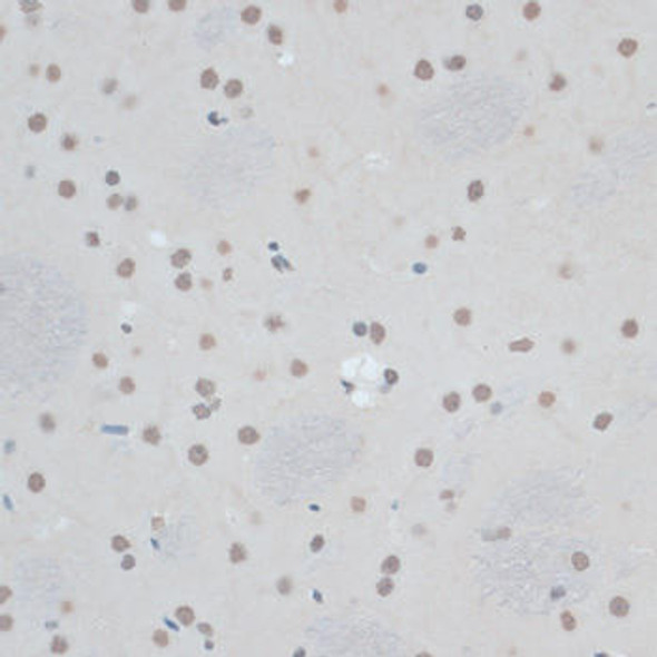 Epigenetics and Nuclear Signaling Antibodies 2 Anti-ZNF433 Antibody CAB14972