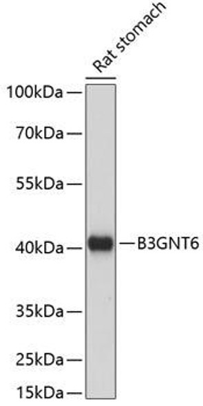 Cell Biology Antibodies 5 Anti-B3GNT6 Antibody CAB14975