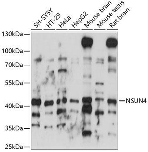 Cell Biology Antibodies 5 Anti-NSUN4 Antibody CAB14983